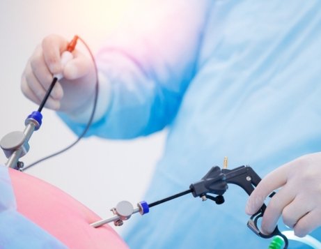 advances in laparoscopic gall bladder surgery